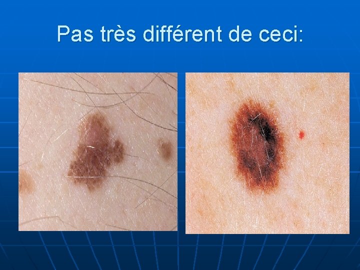 Pas très différent de ceci: 