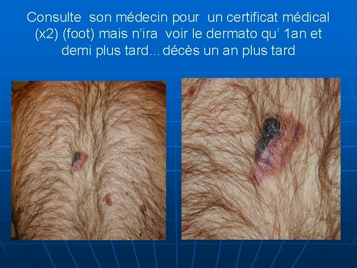 Consulte son médecin pour un certificat médical (x 2) (foot) mais n’ira voir le