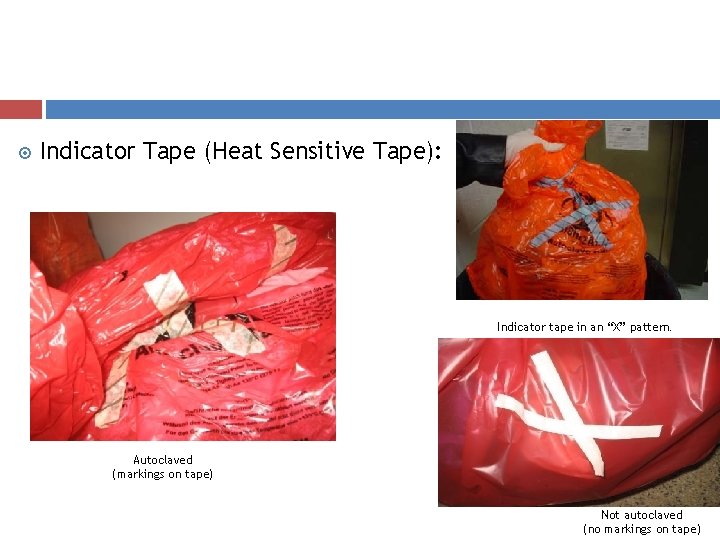  Indicator Tape (Heat Sensitive Tape): Indicator tape in an “X” pattern. Autoclaved (markings