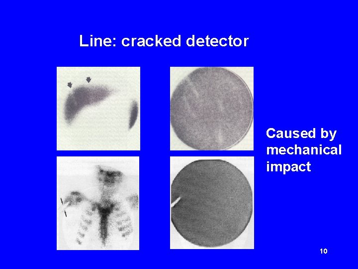 Line: cracked detector Caused by mechanical impact 10 