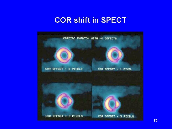 COR shift in SPECT 13 