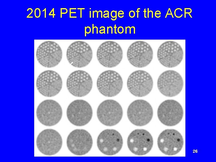 2014 PET image of the ACR phantom 7. 9 mm 26 