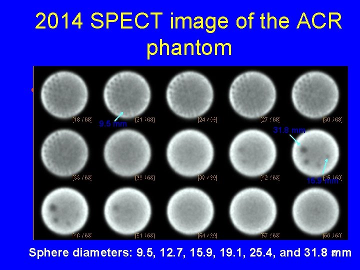 2014 SPECT image of the ACR phantom • as 9. 5 mm 31. 8