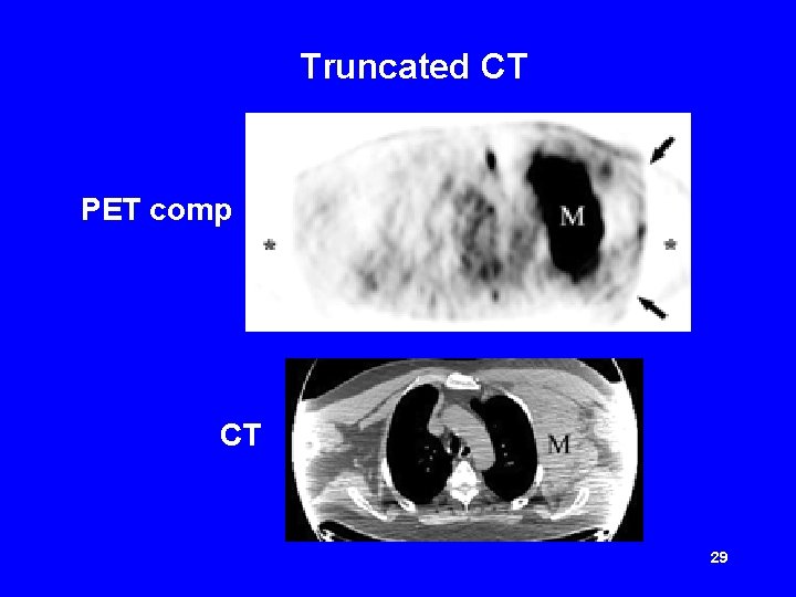 Truncated CT PET comp CT 29 