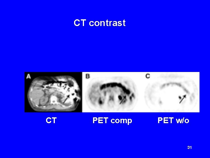 CT contrast CT PET comp PET w/o 31 