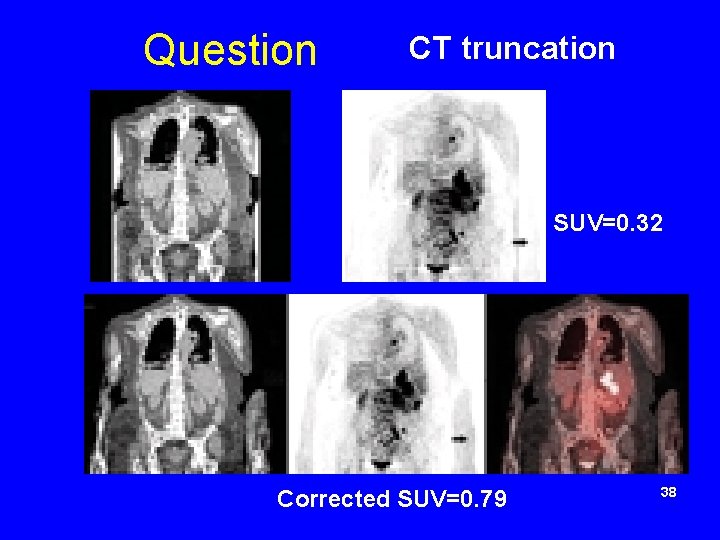 Question CT truncation SUV=0. 32 Corrected SUV=0. 79 38 