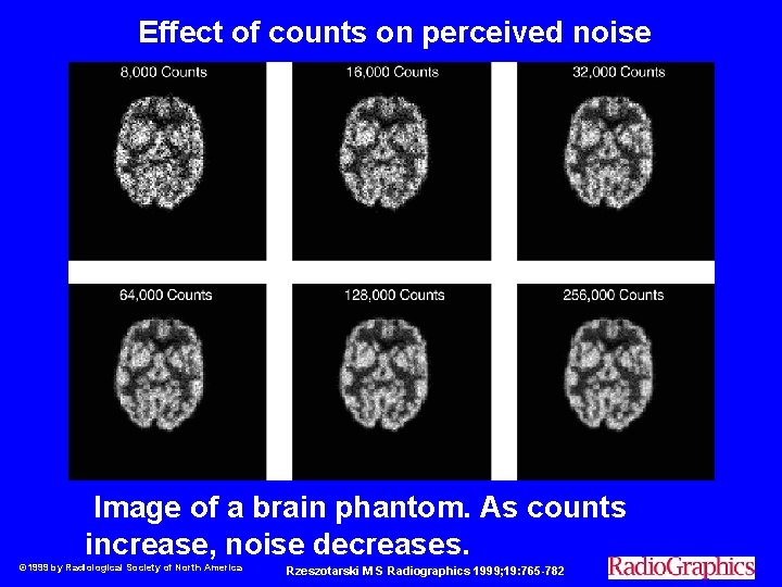  Effect of counts on perceived noise Image of a brain phantom. As counts