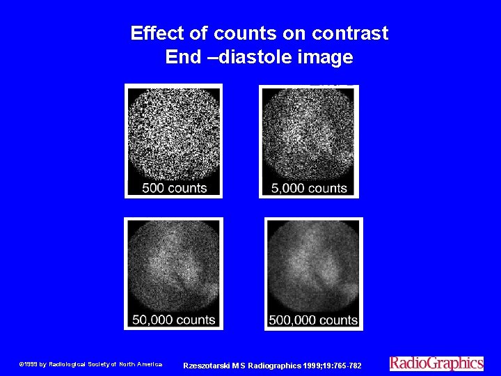 Effect of counts on contrast End –diastole image © 1999 by Radiological Society of