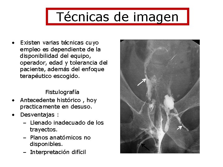 Técnicas de imagen • Existen varias técnicas cuyo empleo es dependiente de la disponibilidad