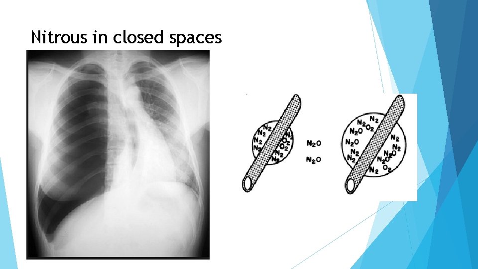 Nitrous in closed spaces 