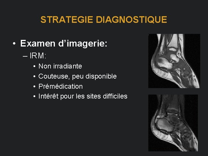 STRATEGIE DIAGNOSTIQUE • Examen d’imagerie: – IRM: • • Non irradiante Couteuse, peu disponible