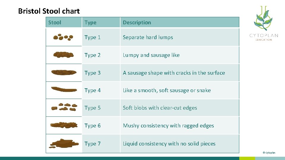 Bristol Stool chart Stool Type Description Type 1 Separate hard lumps Type 2 Lumpy