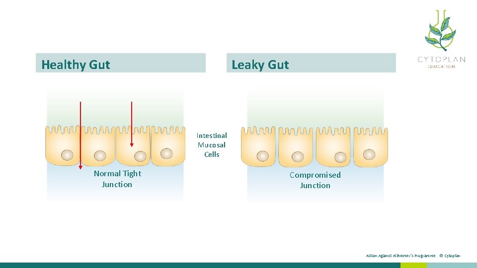 Healthy Gut Leaky Gut Intestinal Mucosal Cells Normal Tight Junction Compromised Junction Against Alzheimer’s