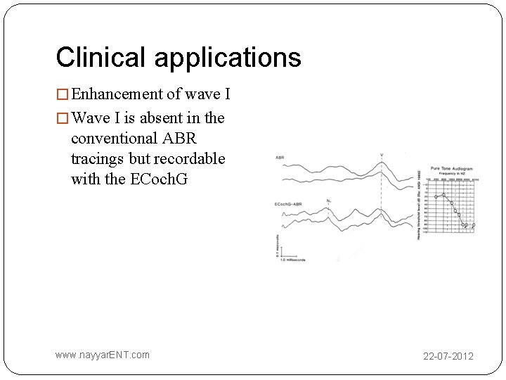 Clinical applications � Enhancement of wave I � Wave I is absent in the