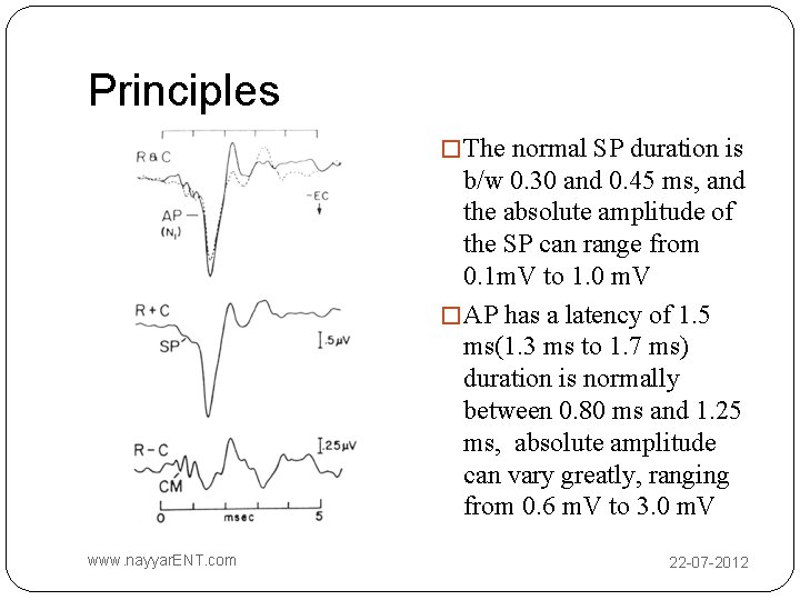 Principles � The normal SP duration is b/w 0. 30 and 0. 45 ms,