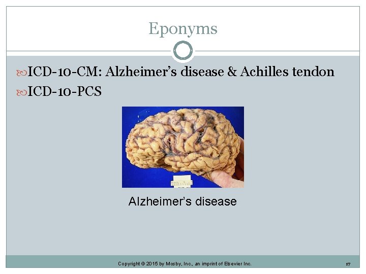 Eponyms ICD-10 -CM: Alzheimer’s disease & Achilles tendon ICD-10 -PCS Alzheimer’s disease Copyright © Eponyms ICD-10 -CM: Alzheimer’s disease & Achilles tendon ICD-10 -PCS Alzheimer’s disease Copyright ©