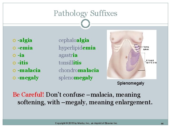 Pathology Suffixes -algia -emia -itis -malacia -megaly cephaloalgia hyperlipidemia agastria tonsillitis chondromalacia splenomegaly Splenomegaly Pathology Suffixes -algia -emia -itis -malacia -megaly cephaloalgia hyperlipidemia agastria tonsillitis chondromalacia splenomegaly Splenomegaly