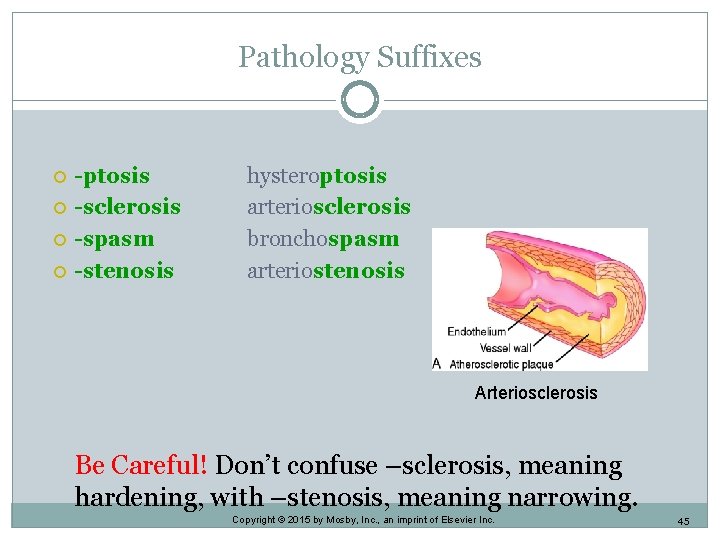 Pathology Suffixes -ptosis -sclerosis -spasm -stenosis hysteroptosis arteriosclerosis bronchospasm arteriostenosis Arteriosclerosis Be Careful! Don’t Pathology Suffixes -ptosis -sclerosis -spasm -stenosis hysteroptosis arteriosclerosis bronchospasm arteriostenosis Arteriosclerosis Be Careful! Don’t