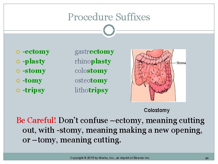 Procedure Suffixes -ectomy -plasty -stomy -tripsy gastrectomy rhinoplasty colostomy osteotomy lithotripsy Colostomy Be Careful! Procedure Suffixes -ectomy -plasty -stomy -tripsy gastrectomy rhinoplasty colostomy osteotomy lithotripsy Colostomy Be Careful!
