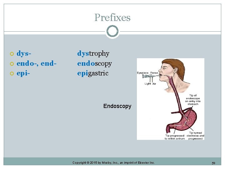 Prefixes dysendo-, endepi- dystrophy endoscopy epigastric Endoscopy Copyright © 2015 by Mosby, Inc. , Prefixes dysendo-, endepi- dystrophy endoscopy epigastric Endoscopy Copyright © 2015 by Mosby, Inc. ,