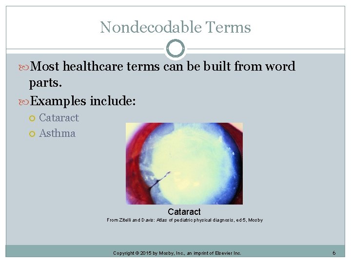 Nondecodable Terms Most healthcare terms can be built from word parts. Examples include: Cataract Nondecodable Terms Most healthcare terms can be built from word parts. Examples include: Cataract