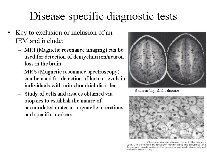 Disease specific diagnostic tests • Key to exclusion or inclusion of an IEM and