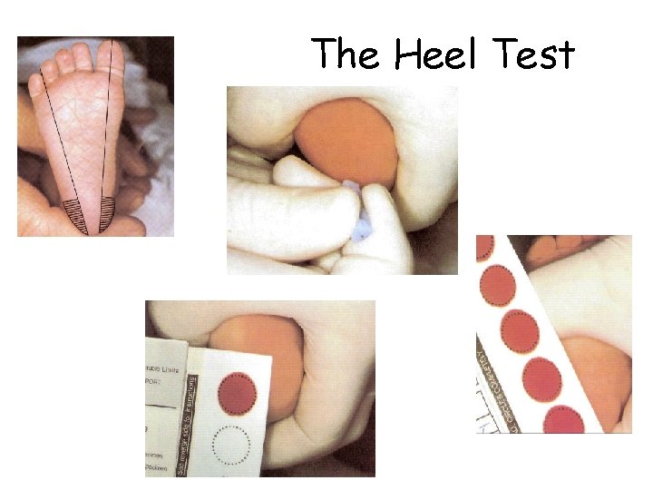 The Heel Test 