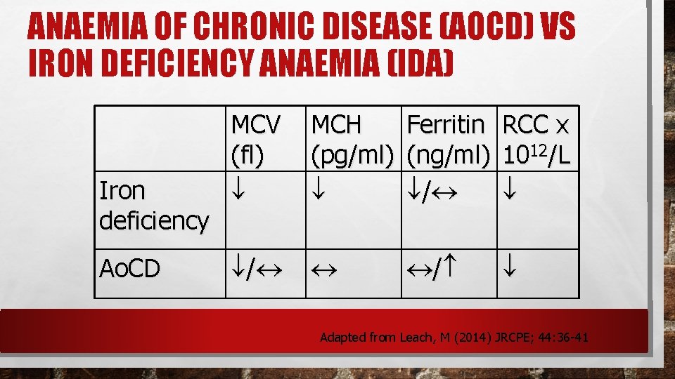 ANAEMIA OF CHRONIC DISEASE (AOCD) VS IRON DEFICIENCY ANAEMIA (IDA) Iron deficiency Ao. CD ANAEMIA OF CHRONIC DISEASE (AOCD) VS IRON DEFICIENCY ANAEMIA (IDA) Iron deficiency Ao. CD