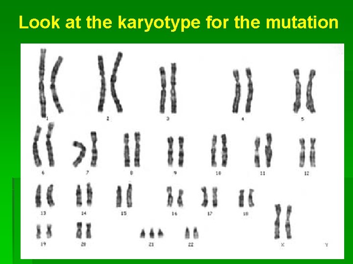 Look at the karyotype for the mutation 