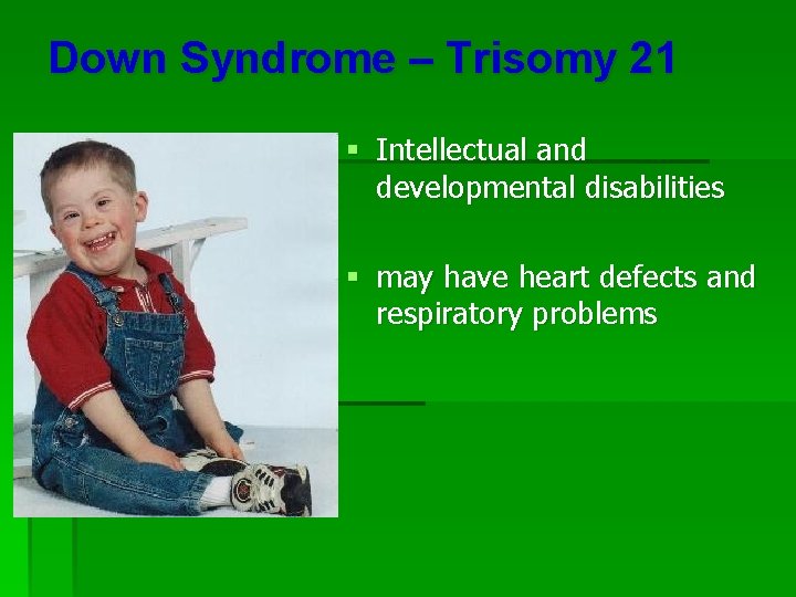 Down Syndrome – Trisomy 21 § Intellectual and developmental disabilities § may have heart