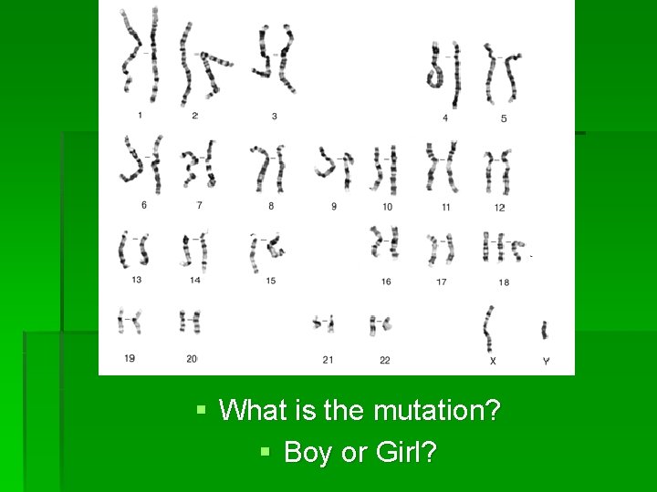 § What is the mutation? § Boy or Girl? 