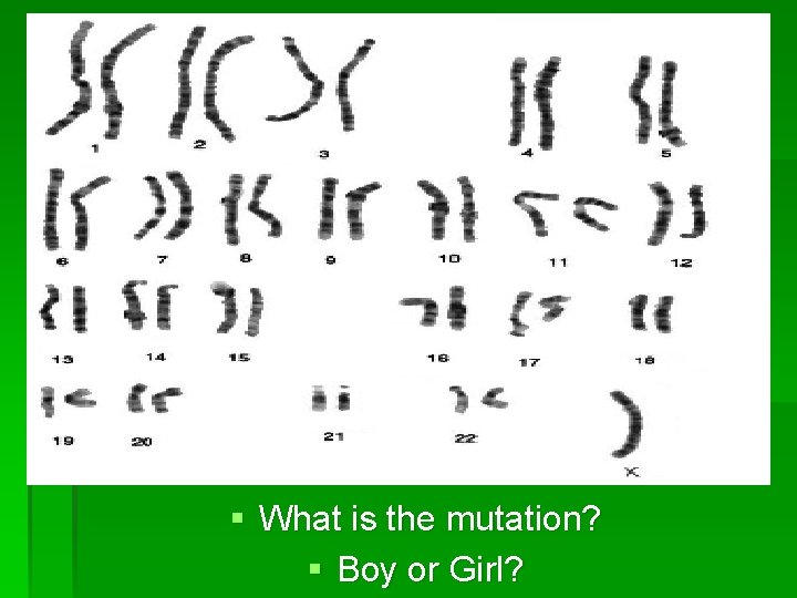 § What is the mutation? § Boy or Girl? 