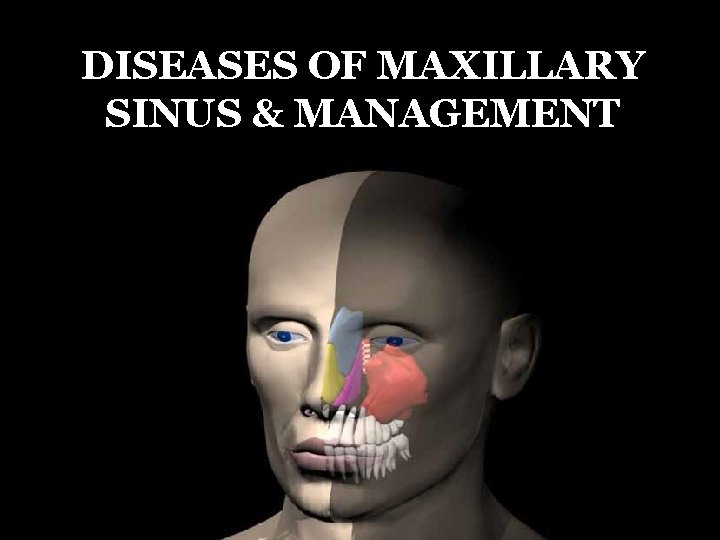 DISEASES OF MAXILLARY SINUS & MANAGEMENT 