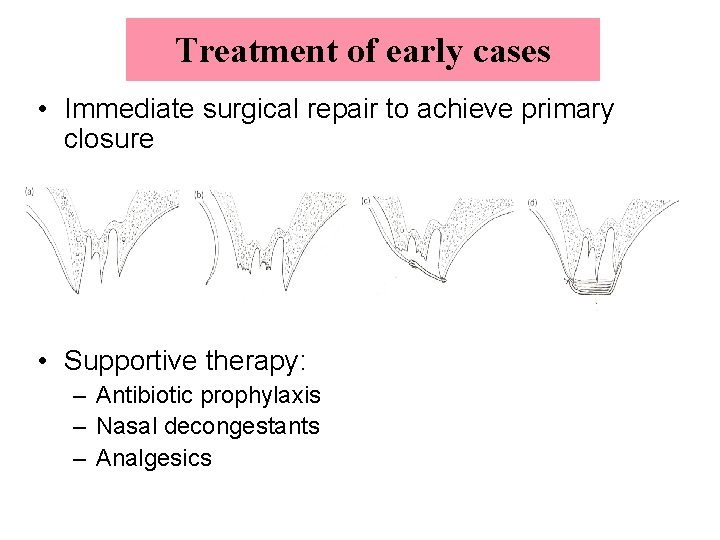 Treatment of early cases • Immediate surgical repair to achieve primary closure • Supportive