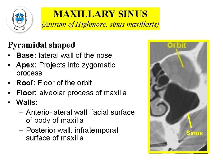 MAXILLARY SINUS (Antrum of Highmore, sinus maxillaris) Pyramidal shaped • Base: lateral wall of