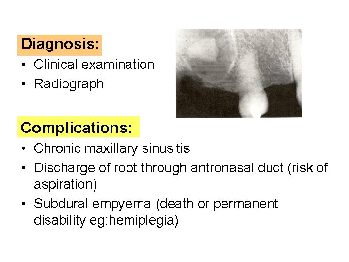 Diagnosis: • Clinical examination • Radiograph Complications: • Chronic maxillary sinusitis • Discharge of
