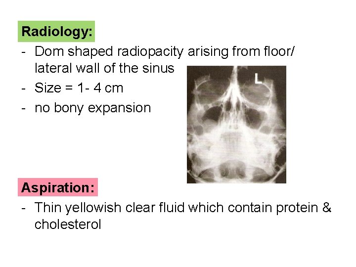 Radiology: - Dom shaped radiopacity arising from floor/ lateral wall of the sinus -