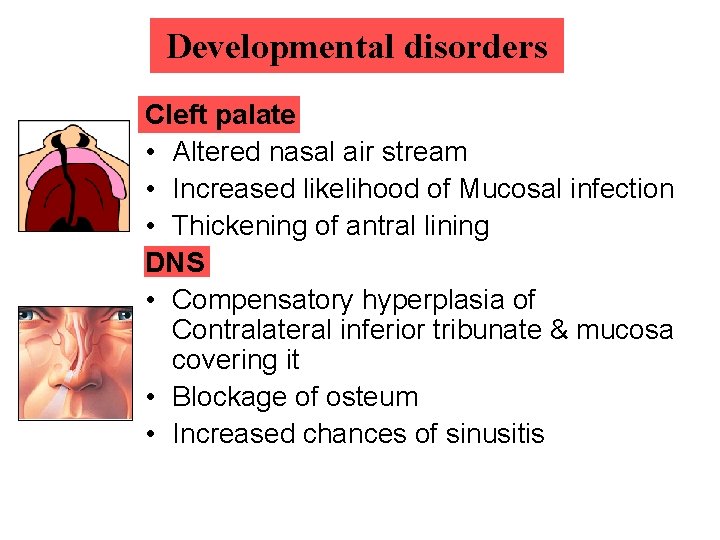 Developmental disorders Cleft palate • Altered nasal air stream • Increased likelihood of Mucosal