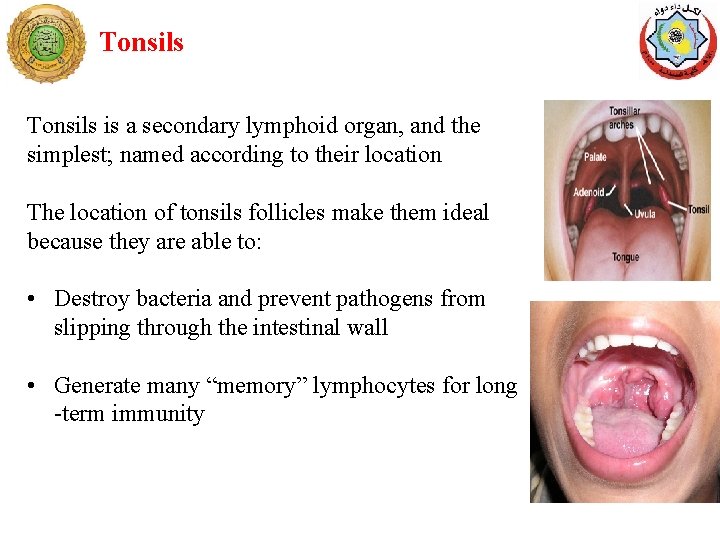 Tonsils is a secondary lymphoid organ, and the simplest; named according to their location