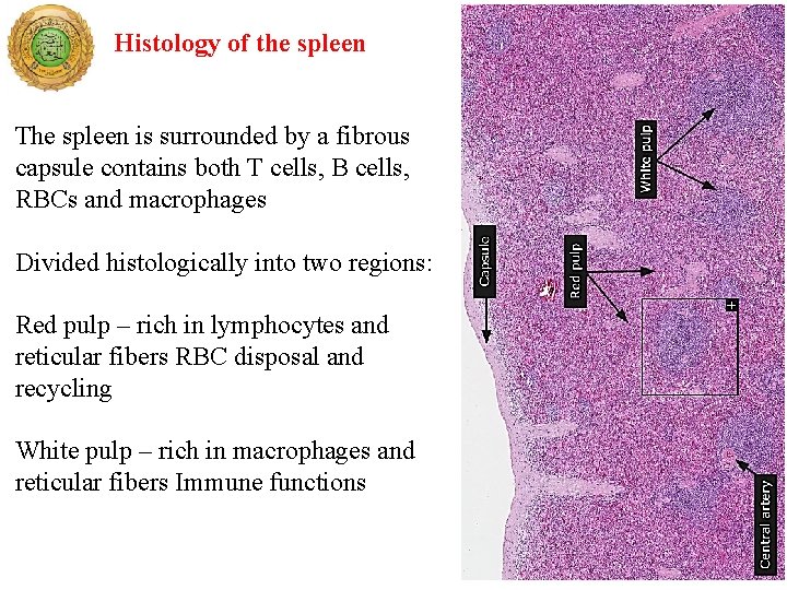 Histology of the spleen The spleen is surrounded by a fibrous capsule contains both