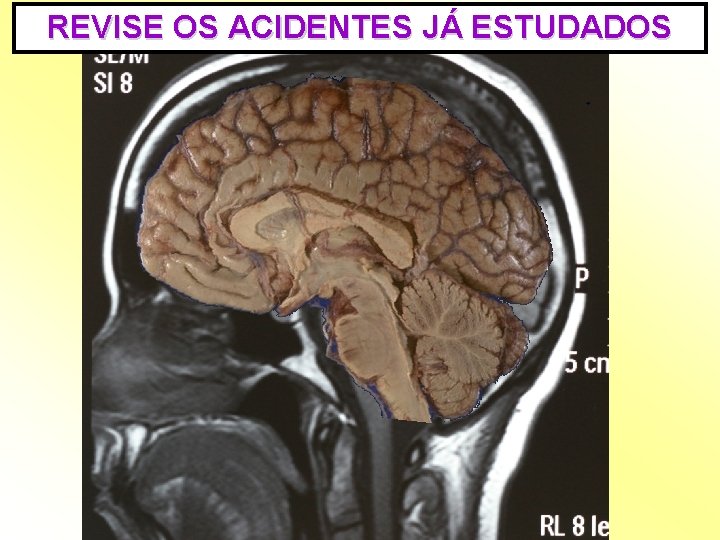 REVISE OS ACIDENTES JÁ ESTUDADOS 