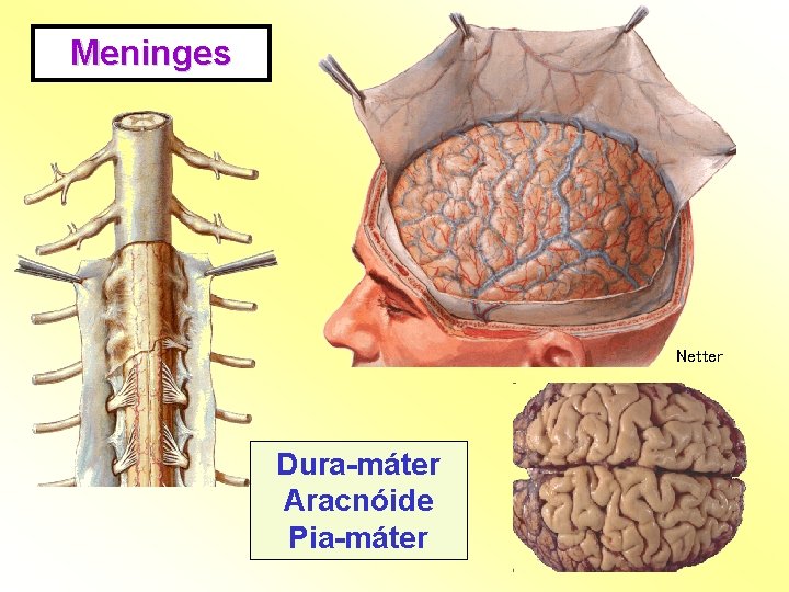 Meninges Netter Dura-máter Aracnóide Pia-máter 