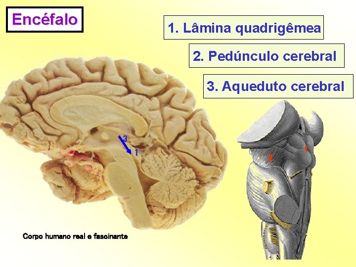 Encéfalo 1. Lâmina quadrigêmea 2. Pedúnculo cerebral 3. Aqueduto cerebral 3 1 Corpo humano