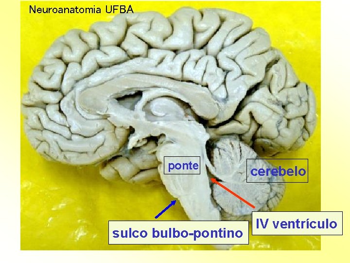 Neuroanatomia UFBA ponte sulco bulbo-pontino cerebelo IV ventrículo 