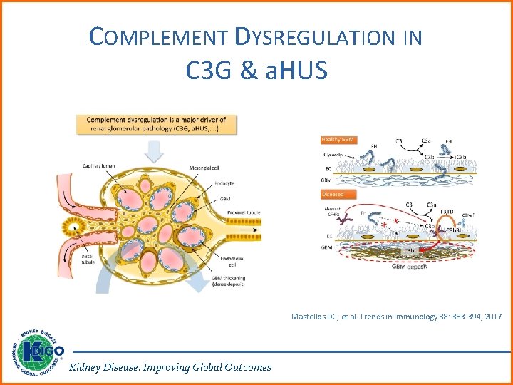 COMPLEMENT DYSREGULATION IN C 3 G & a. HUS Mastellos DC, et al. Trends