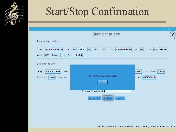 Start/Stop Confirmation 
