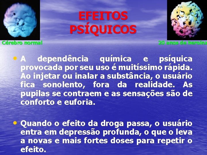 EFEITOS PSÍQUICOS Cérebro normal 20 anos de heroína • A dependência química e psíquica
