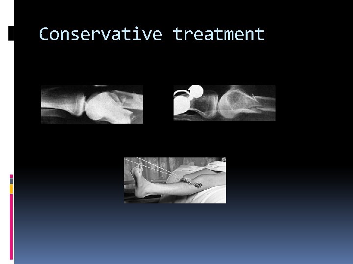 Conservative treatment 