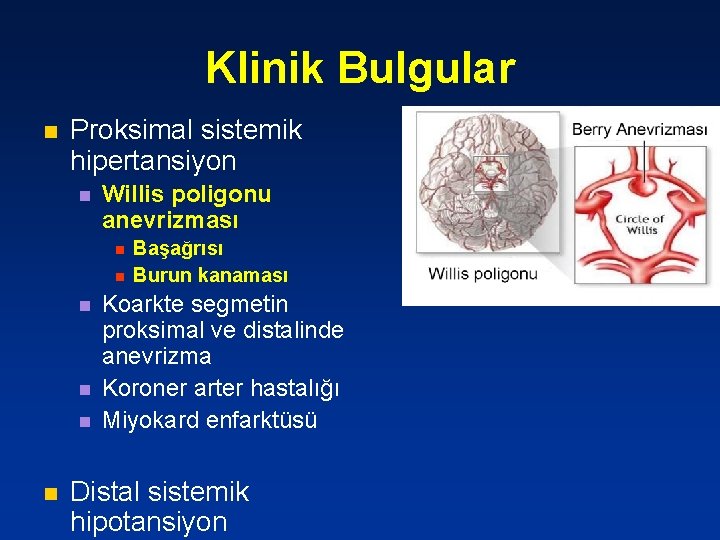 Klinik Bulgular n Proksimal sistemik hipertansiyon n Willis poligonu anevrizması n n n Başağrısı