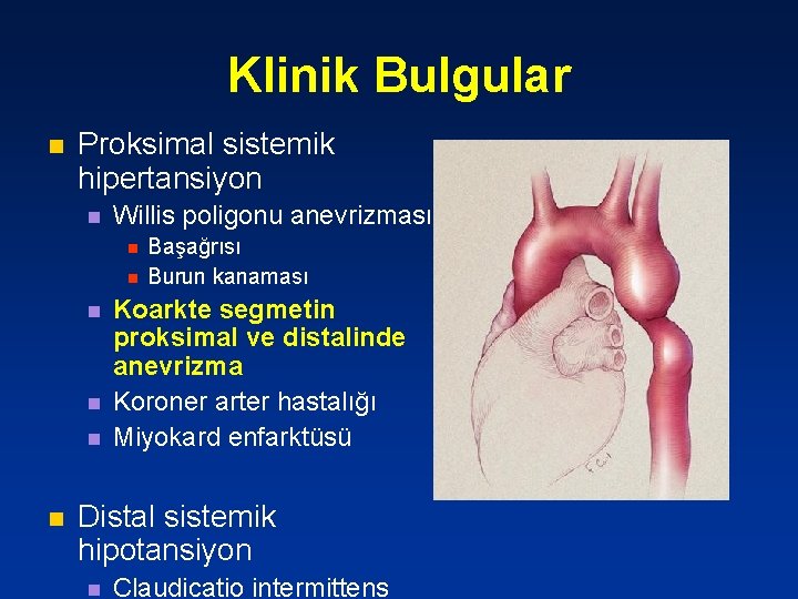 Klinik Bulgular n Proksimal sistemik hipertansiyon n Willis poligonu anevrizması n n n Başağrısı